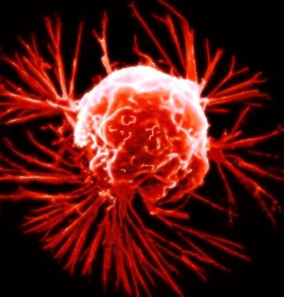 a breast cancer cell