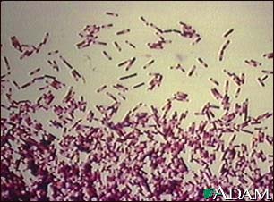 bacteria 5897 bacteria 5897