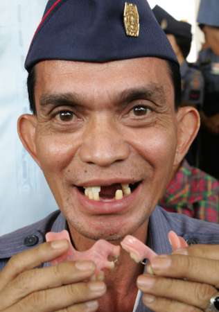 bad teeth