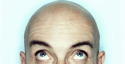 baldhead 64