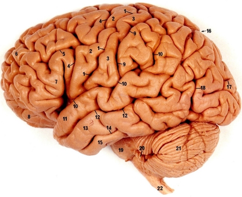 brain 2