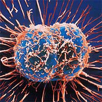 cancer cell 4709