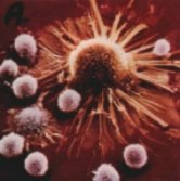 cancerous cells 4515