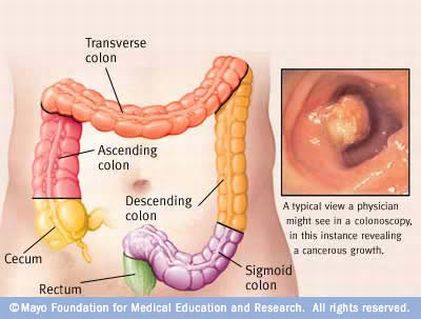 colon