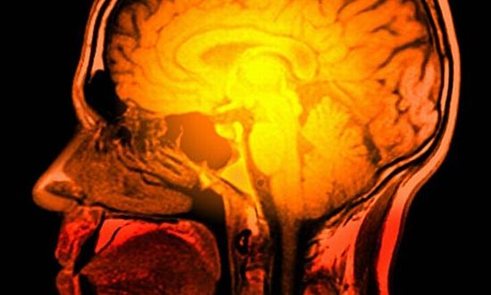 coloured magnetic resonance imaging mri scan of a coloured magnetic resonance imaging mri scan of a