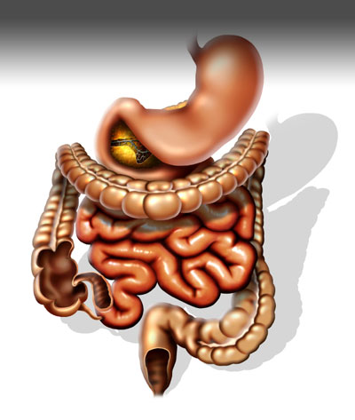 Triphala churna: 6 Negative side effects 10 Triphala churna: 6 Negative side effects damage of colon muscles image title zhyb1