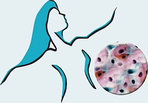human papillomavirus 50