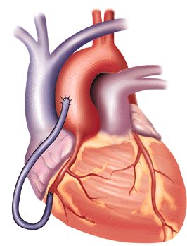 humanheart