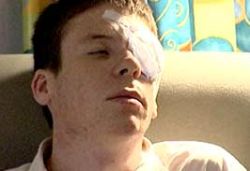 injecting eye with genes 9