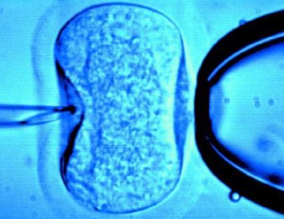 ivf
