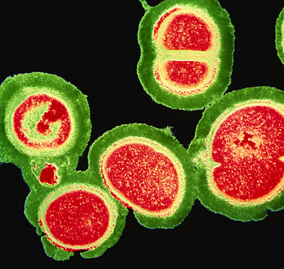 mrsa mrsa