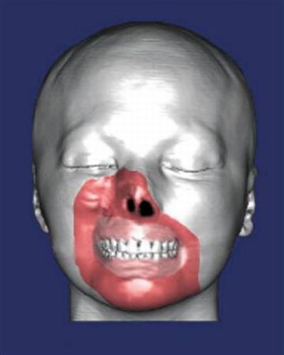 partialface