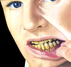 smokeless tobacco