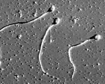 sperms