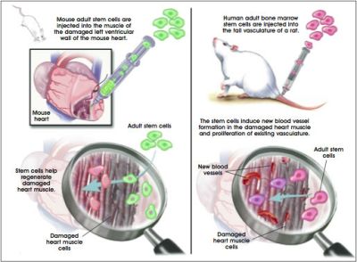 stemcells