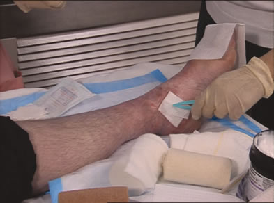 treatment 246