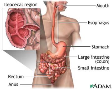 unusual bacteria may trigger crohns disease