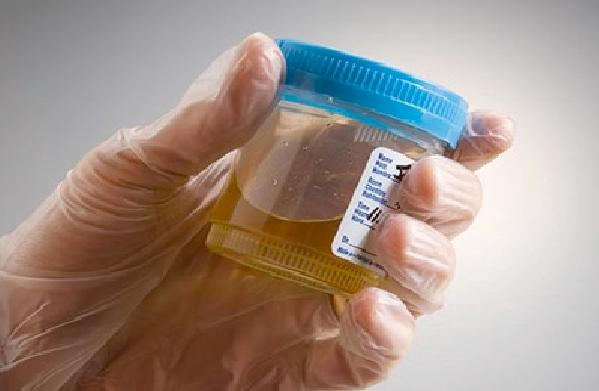 Urine therapy