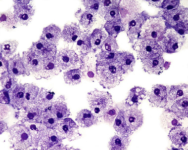 white blood cells 5257