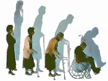 women past menopause fal victim to osteoporosis