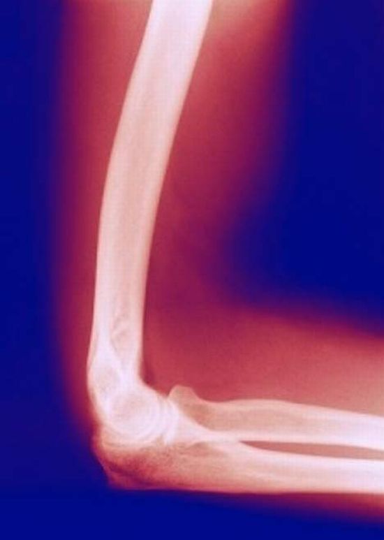 xraydm0604 468x658 8167