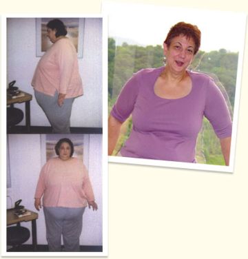 yo yo dieting can increase the risk of kidney canc